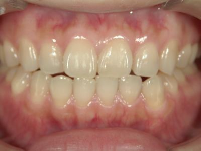 SHOFU DENTAL DIGITAL CAMERA