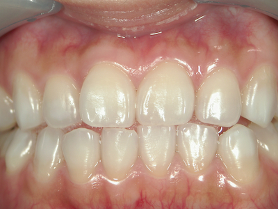 SHOFU DENTAL DIGITAL CAMERA